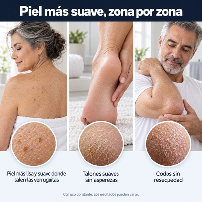 NurioLabs | Barra corporal exfoliante  Con ácido glicólico